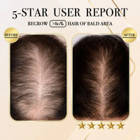 Thumbnail for Ginger Hair Regrowth Shampoo Bar - thedealzninja