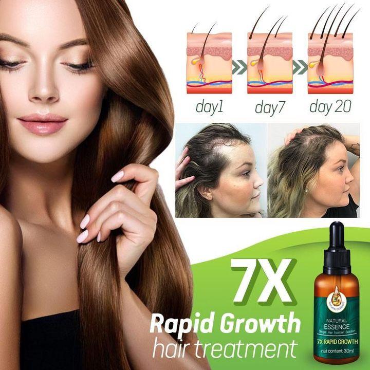 7X Rapid Growth Hair Treatment - thedealzninja