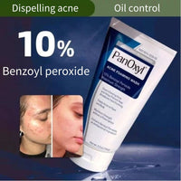 Thumbnail for PanOxyl Acne Foaming Wash
