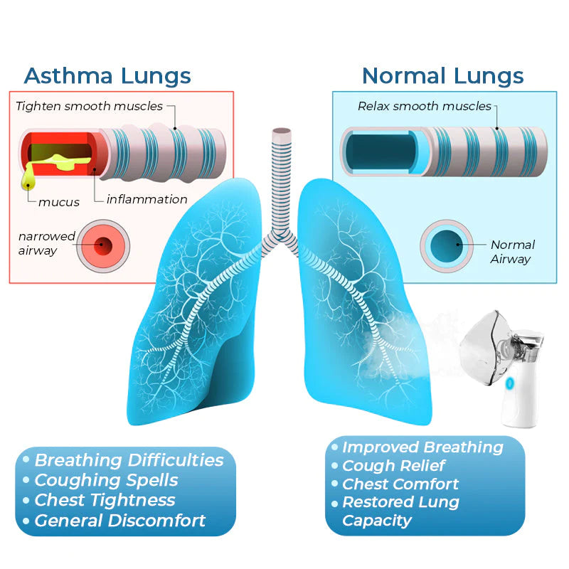 GFOUK™ LungDetox Nebulizer Cleansing Spray