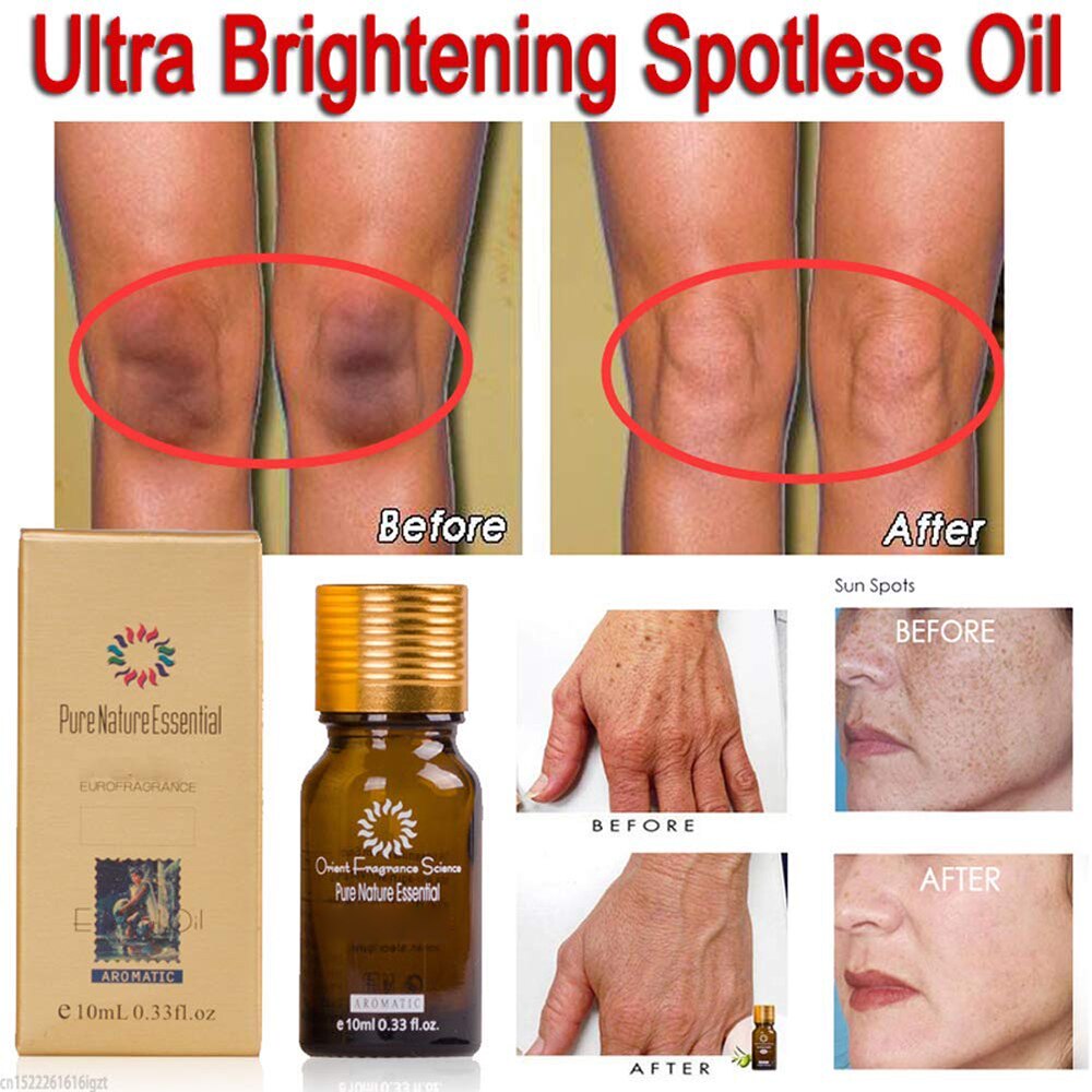 Ultra Brightening Spotless Oil - thedealzninja