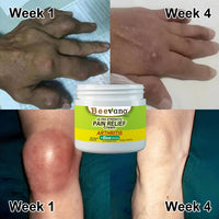 Thumbnail for Beevana™ Bee Venom Joint & Bone Therapy Cream (Full Body Recovery, Pure Natural Formula) - Givemethisnow