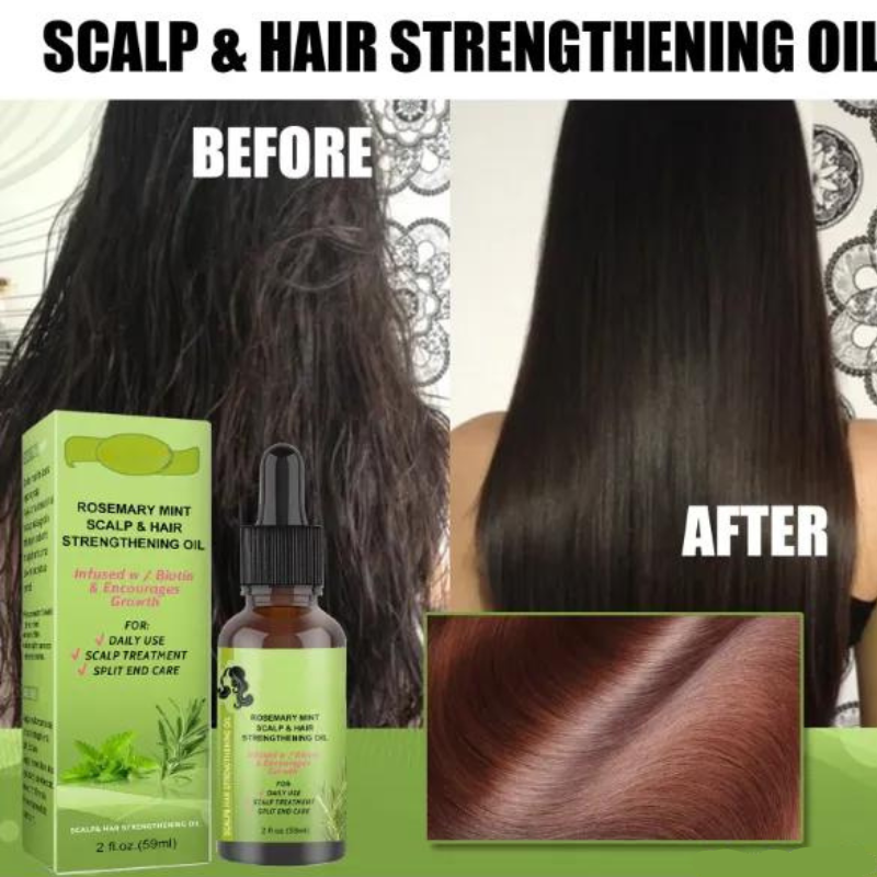 Rosemary Mint Scalp & Hair Strengthening Oil – thedealzninja