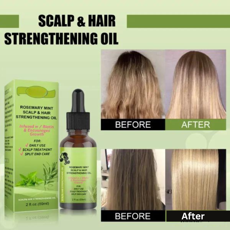 Rosemary Mint Scalp & Hair Strengthening Oil - thedealzninja