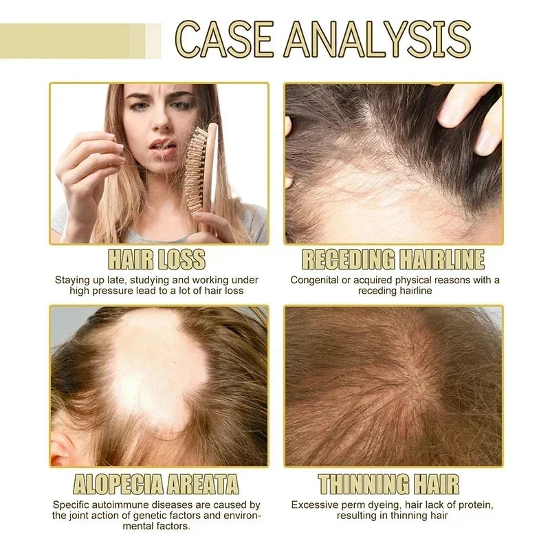 Carvenhy™ Veganic Hair Oil - thedealzninja