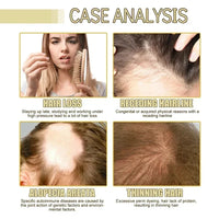 Thumbnail for Carvenhy™ Veganic Hair Oil - thedealzninja