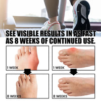 Thumbnail for Orthofeet Bunion Relief Socks