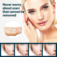 Thumbnail for Advance Silicone Scar Remover Gel - thedealzninja