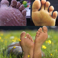Thumbnail for Anti-fungal Peeling Foot Soak - thedealzninja