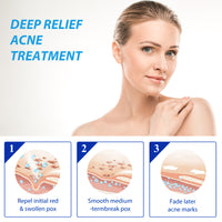 Thumbnail for EELHOE™ Dark Spot and Acne Treatment Lotion - thedealzninja