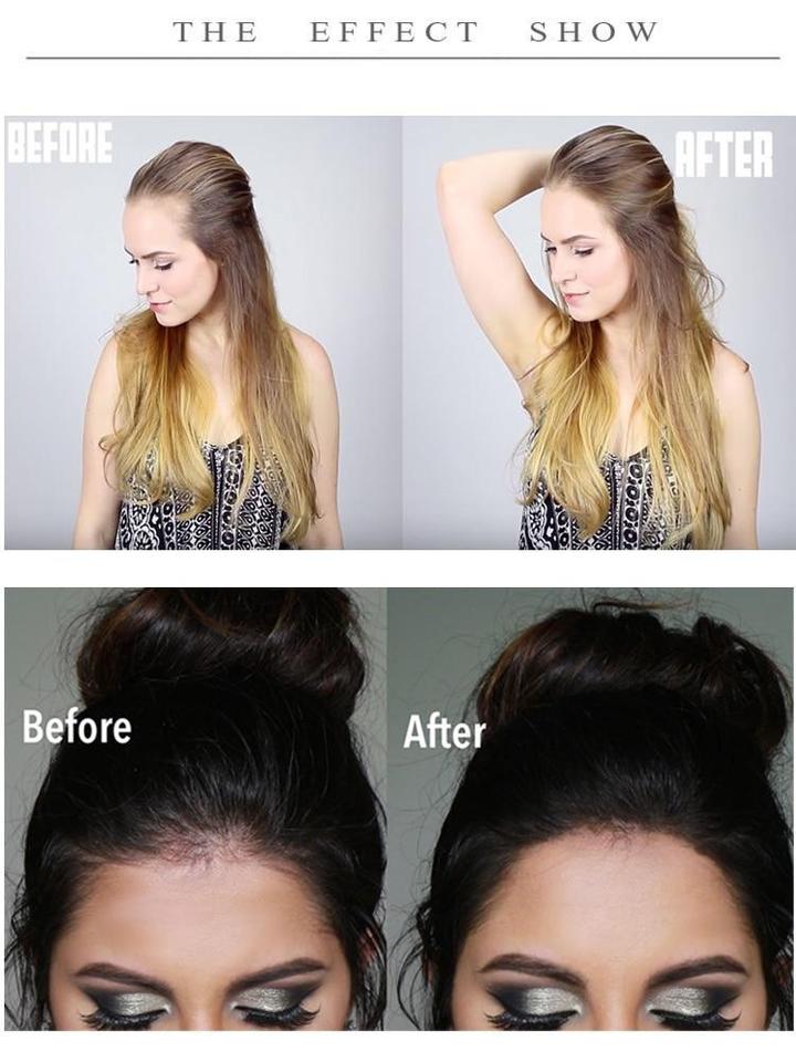 ROLL-ON HAIR GROWTH SERUM - thedealzninja