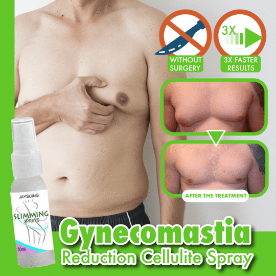Gynecomastia Reduction Cellulite Spray - thedealzninja