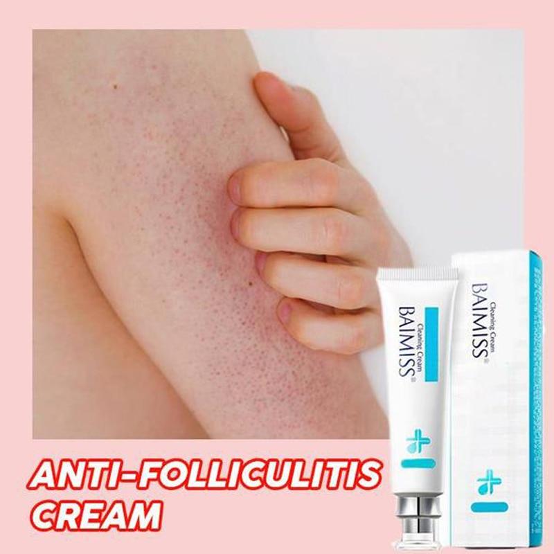 Anti-Folliculitis Cream - thedealzninja