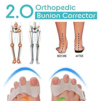 Thumbnail for Orthopedic Bunion Corrector 2.0(1 PAIR) - thedealzninja