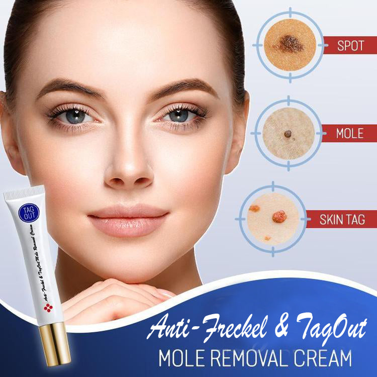 Anti-Freckle & TagOut Mole Removal Cream - thedealzninja