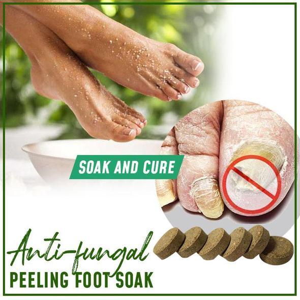 Anti-fungal Peeling Foot Soak - thedealzninja