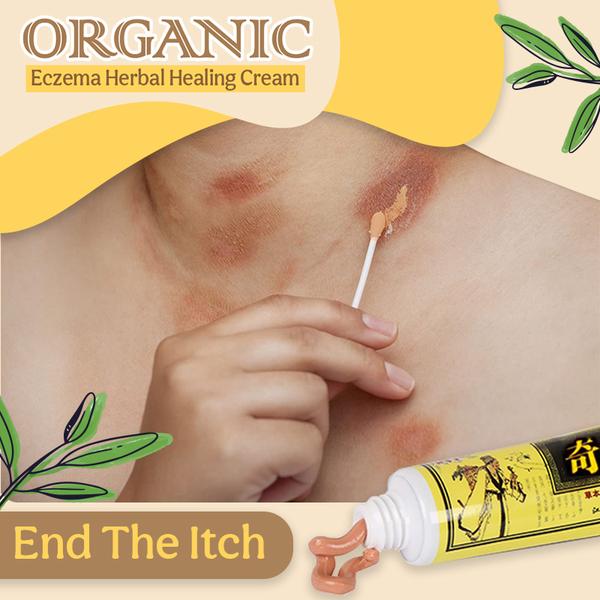 Organic Eczema Herbal Healing Cream - thedealzninja