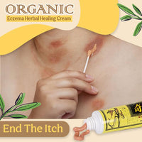Thumbnail for Organic Eczema Herbal Healing Cream - thedealzninja