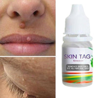 Thumbnail for Skin Tag Remover - thedealzninja