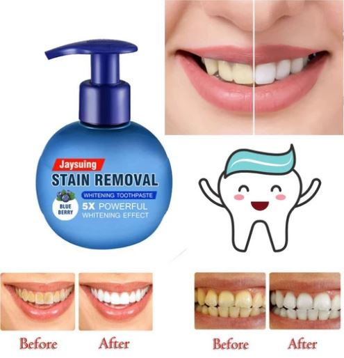 Intensive Stain Removal Whitening Toothpaste - thedealzninja