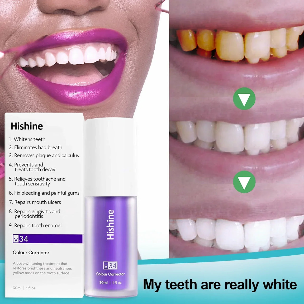 Oveallgo™ Pure Herbal Teeth Whitening Mousse - thedealzninja
