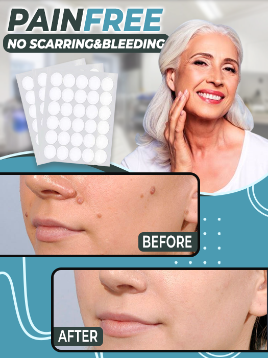 Skin Tag Remover Patch - thedealzninja
