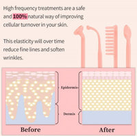 Thumbnail for NuDerma High Frequency Skin Therapy Wand Machine - thedealzninja