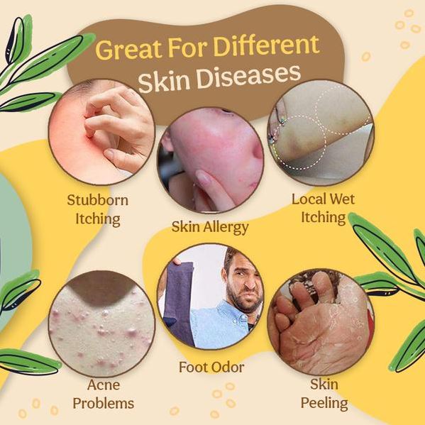 Herbal Healing Cream Eczema and Psoriasis - thedealzninja