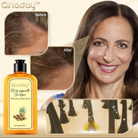 Thumbnail for Ginaday™ Instant Ginger Hair Regrowth Shampoo - thedealzninja