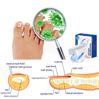 Thumbnail for Oveallgo™ NanoPRO Revolutionary High-Efficiency Light Therapy Device For Toenail Diseases