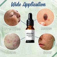 Thumbnail for ActiveSkin Mole Removal Serum - thedealzninja
