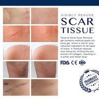 Thumbnail for Advance Silicone Scar Remover Gel - thedealzninja