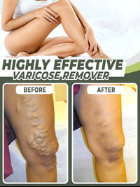 Thumbnail for Varicose Veins Healing Patch - thedealzninja