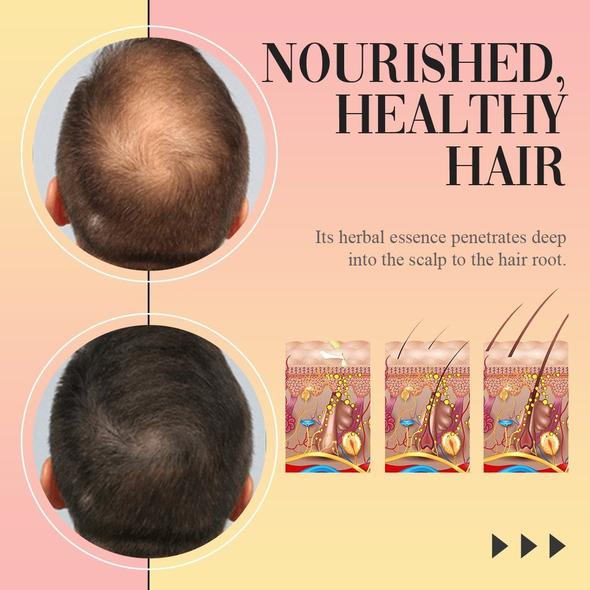 Advanced Hair Booster - thedealzninja
