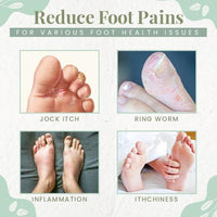 Thumbnail for Anti-Fungal Peeling Foot Soak - thedealzninja