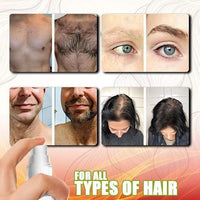 Thumbnail for GingerGrowth Anti-Hair Loss Spray - thedealzninja
