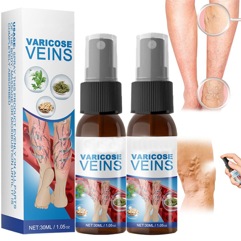 Veinhealing Varicose Veins Treatment Spray - thedealzninja