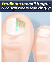 Thumbnail for Anti-fungal Peeling Foot Soak - thedealzninja