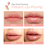 Thumbnail for DEROL™ Lip Plumper Kit - thedealzninja