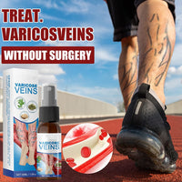 Thumbnail for Veinhealing Varicose Veins Treatment Spray - thedealzninja