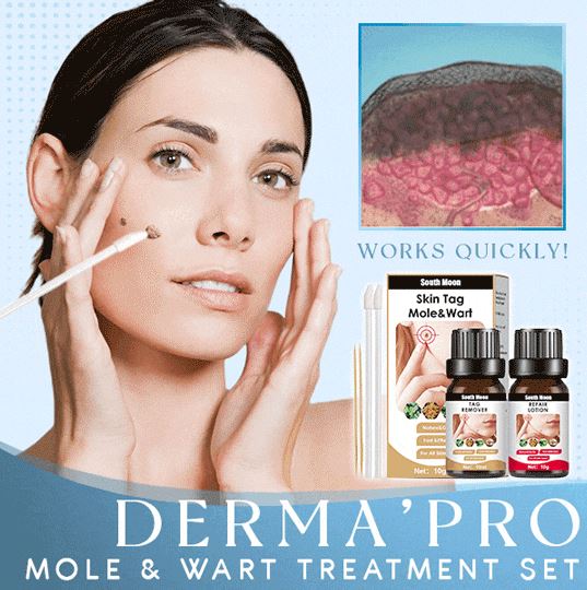Derma'Pro Mole & Wart Remove Treatment Set - thedealzninja