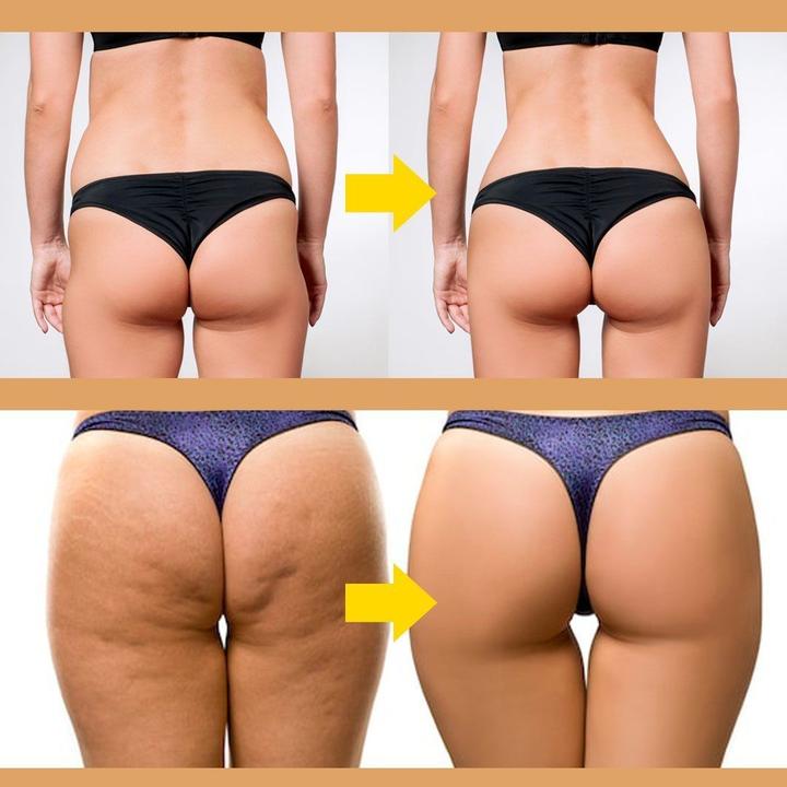 Butt Lift Shaping Patch - thedealzninja