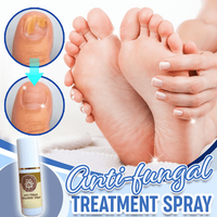 Thumbnail for Anti-Fungal Treatment Spray - thedealzninja