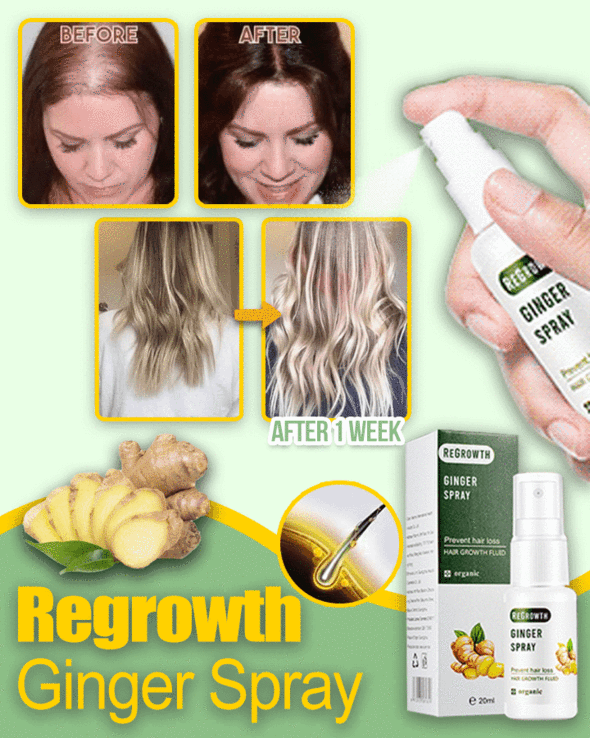 GingerGrowth Anti-Hair Loss Spray - thedealzninja