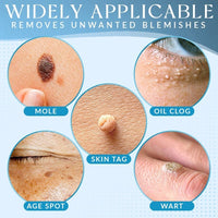 Thumbnail for Derma'Pro Mole & Wart Remove Treatment Set - thedealzninja