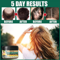 Thumbnail for Natural Hair Growth Ginger Cream - thedealzninja