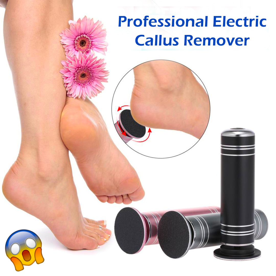 Professional Electric Callus Remover - thedealzninja