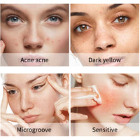 Thumbnail for Dark Spot Turmeric Skin Care Set