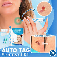Thumbnail for Auto Tag Removal Kit - thedealzninja
