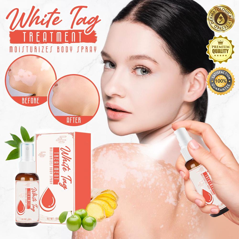 White Tag Treatment Moisturizes Body Spray - thedealzninja